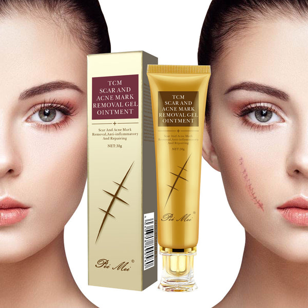 TCM Scar and Acne Mark Removal Gel Ointment with packaging on a white background