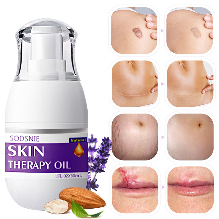 SODSNIE Skin Therapy Oil bottle with before and after skin condition images on a white background