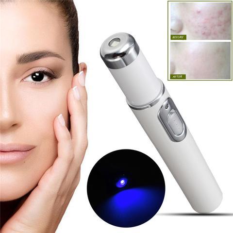 Facial skin treatment device with before and after effect on a woman's face.