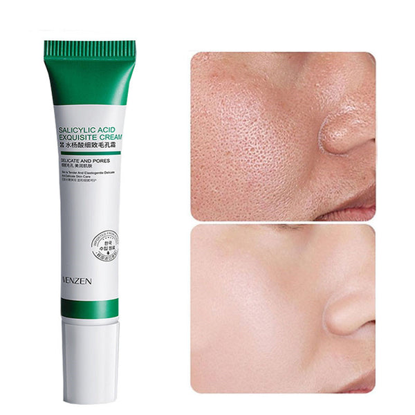 Pore Refinement Cream - 20ml Advanced Salicylic Acid Chitosan Technology