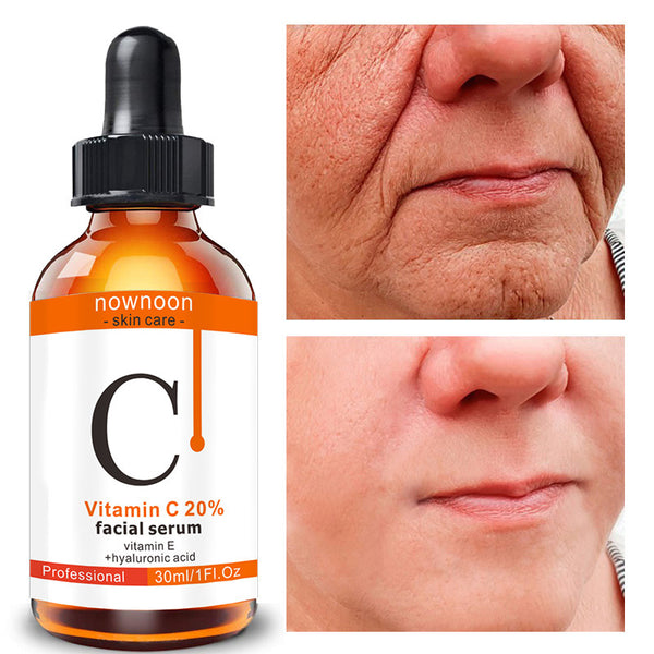 Vitamin C Serum - Premium Snow Lotus Hydrating 30ml Professional Anti-Aging