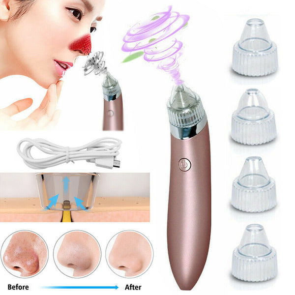 Beauty device with attachments and before-and-after effects on skin shown.