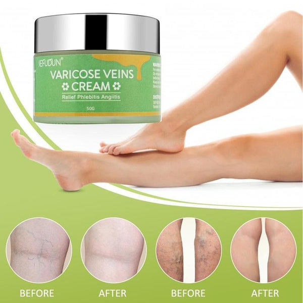 Varicose veins cream jar with before and after effects on legs on a green background